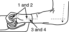 Elbow Posture / Position Graphic